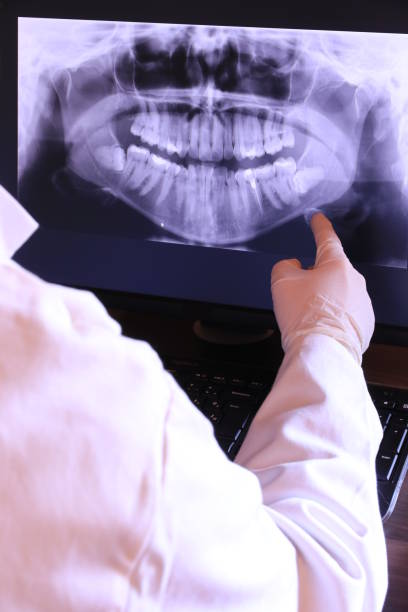 Best Emergency Dentist for Lost Fillings or Crowns in Kimberling City, MO